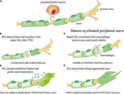 Engineered Schwann Cell-Based Therapies for Injury Peripheral Nerve Reconstruction